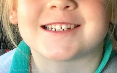 Los dientes de leche: más bocadillos y menos bollos